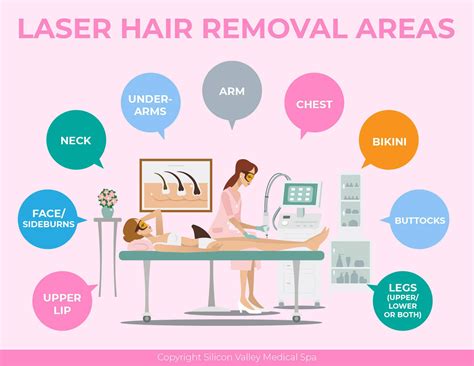 china laser hair removal areas